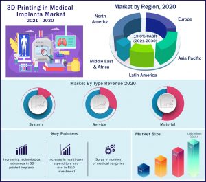 3D Printing Medical Implants